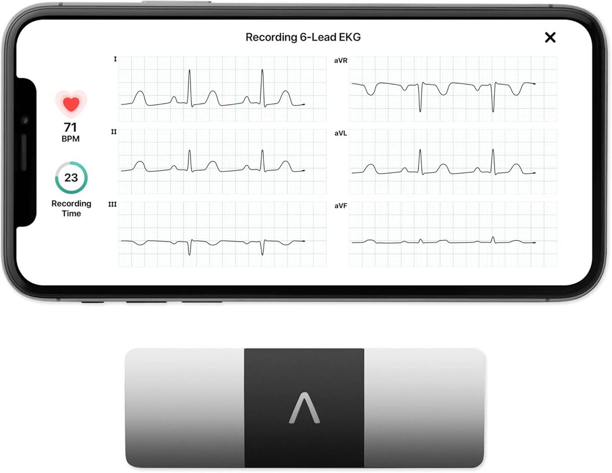 Test de l'AliveCor KardiaMobile 6L : moniteur ECG innovant et connecté