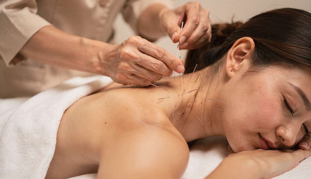 Acupuncture et arthrose cervicale : une solution efficace ?